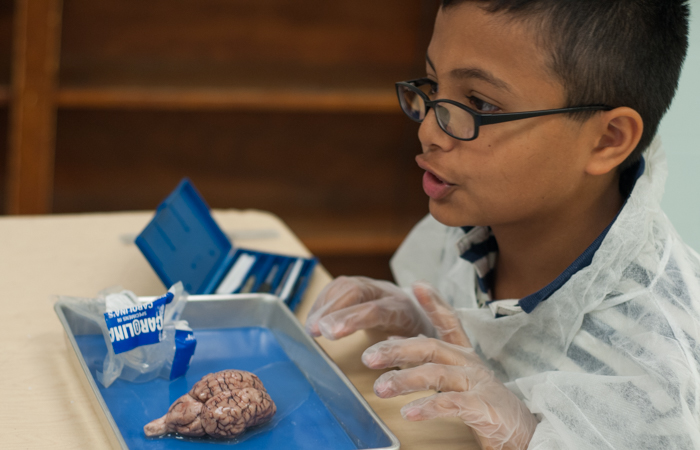 A student answers review questions about brain lobes and functions before dissection.