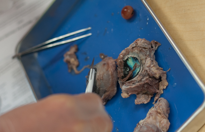 A successful dissection of an eye, with the lens removed.